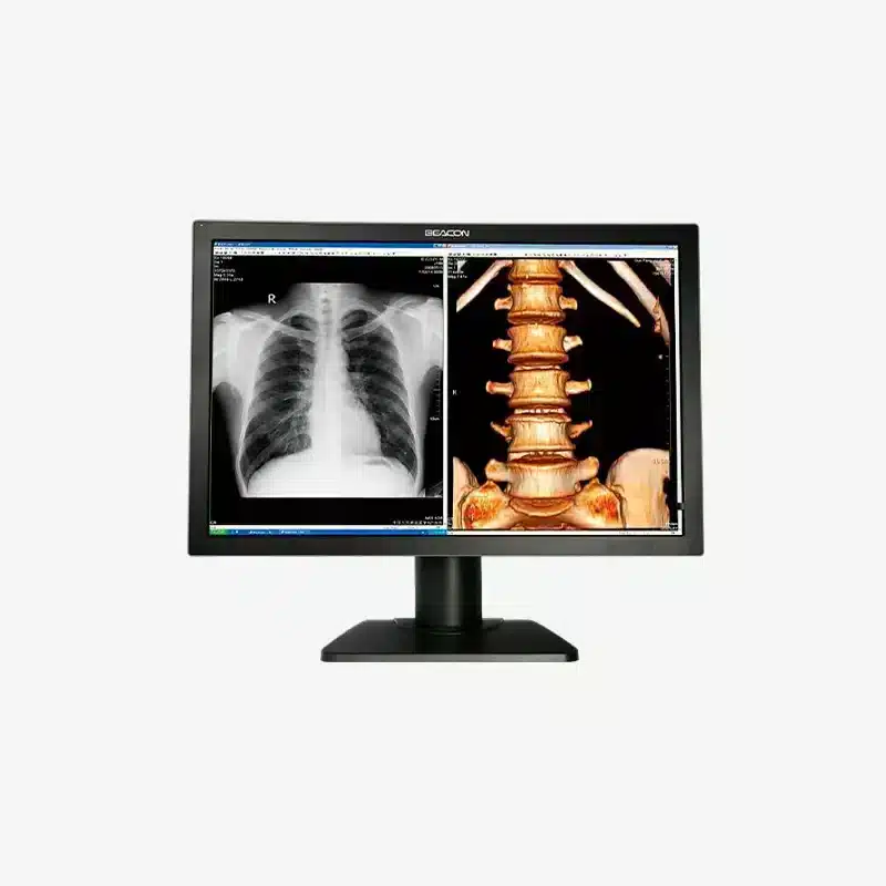 Monitor grado médico - BEACON